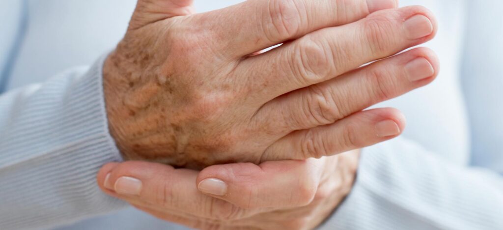 Managing Arthritis: Tips for Seniors