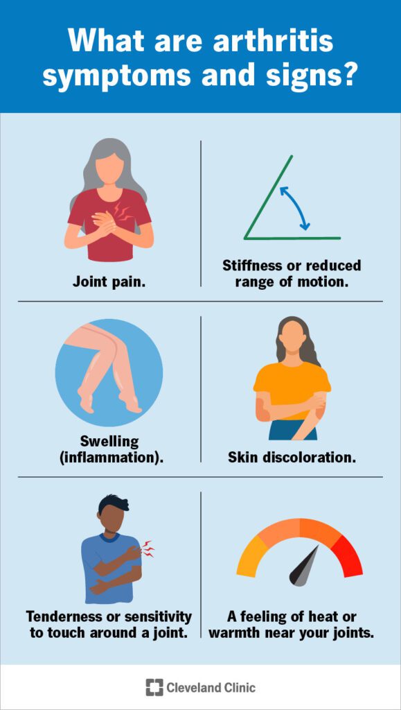 artritis infografía